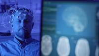 Epilepsy study